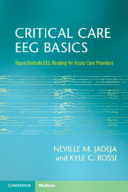 Critical Care EEG Basics