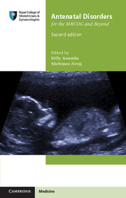 Antenatal Disorders for the MRCOG and Beyond