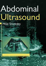 Abdominal Ultrasound Made Easy Step By Step Guide Pocus Off