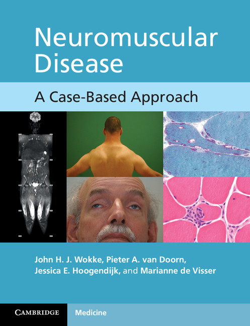 Neuromuscular Disease