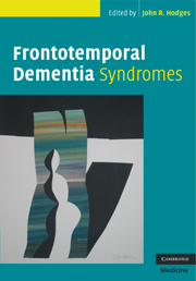 Frontotemporal Dementia Syndromes