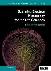 Scanning Electron Microscopy for the Life Sciences