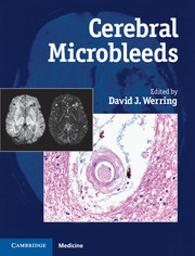 Cerebral Microbleeds