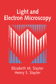 Light and Electron Microscopy