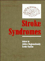 Stroke Syndromes