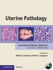 Uterine Pathology