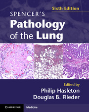 Spencer's Pathology of the Lung