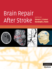 Brain Repair After Stroke