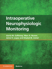 Intraoperative Neurophysiologic Monitoring