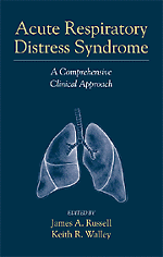 Acute Respiratory Distress Syndrome