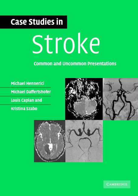 stroke case study quizlet
