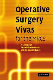 Operative Surgery Vivas for the MRCS