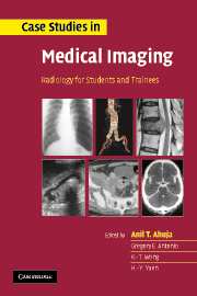 Case Studies in Medical Imaging