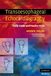 Transoesophageal Echocardiography