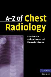 A-Z of Chest Radiology