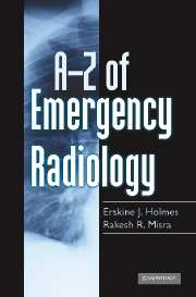 A-Z of Emergency Radiology