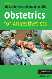 Obstetrics for Anaesthetists