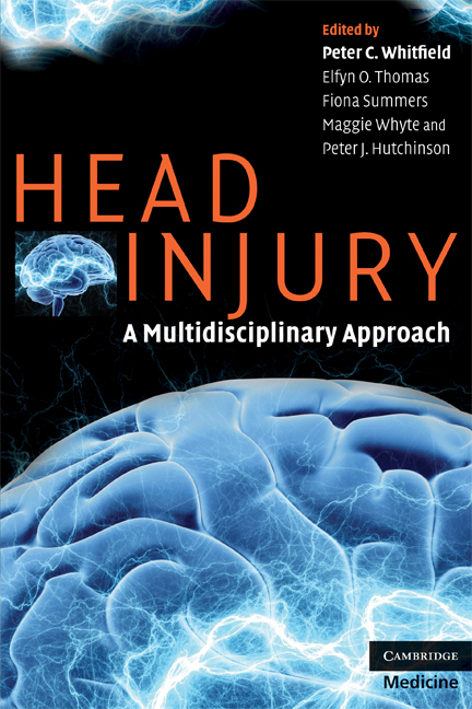 dealing-with-a-traumatic-brain-injury-after-a-car-accident-injured