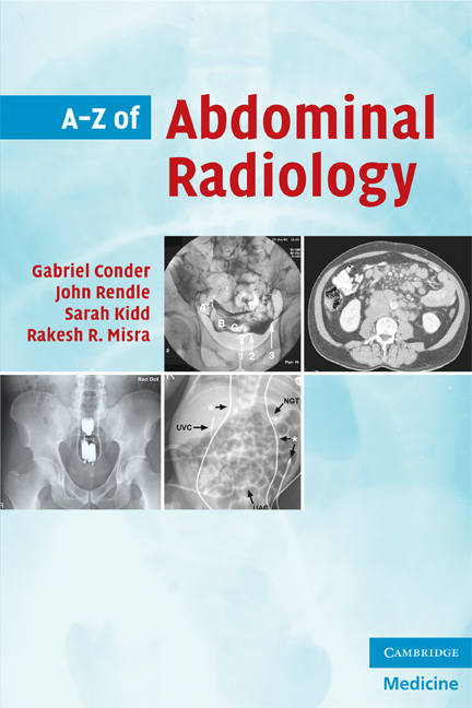 A-Z Of Abdominal Radiology