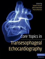 Core Topics in Transesophageal Echocardiography