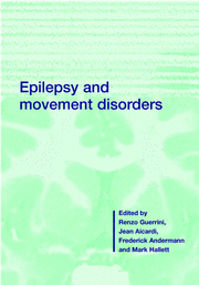 Epilepsy and Movement Disorders