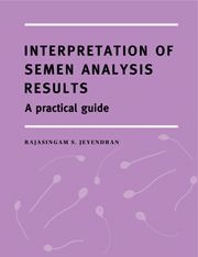 Interpretation of Semen Analysis Results