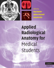 Applied Radiological Anatomy for Medical Students (2009) (PDF) Paul Butler