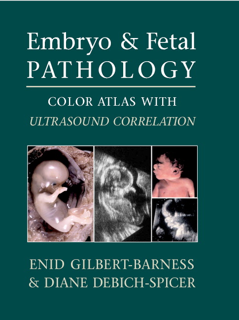 Download Embryo And Fetal Pathology