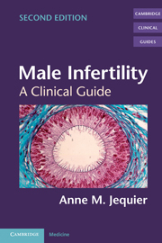 Male Infertility