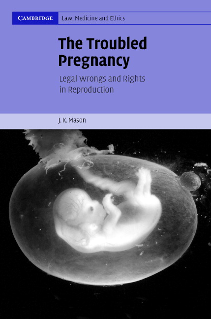 voluntary-and-involuntary-termination-of-pregnancy-chapter-2-the