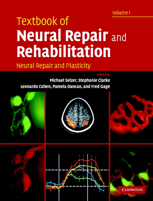 Functional electrical stimulation in neurorehabilitation (Chapter 12) -  Textbook of Neural Repair and Rehabilitation