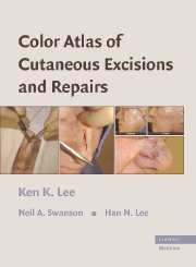 Color Atlas of Cutaneous Excisions and Repairs