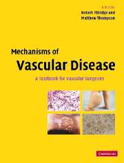 Mechanisms vascular disease textbook vascular surgeons | Cardiology ...