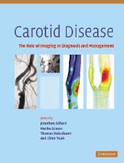 Carotid Disease