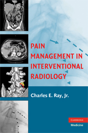 Pain Management in Interventional Radiology