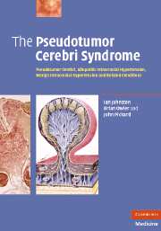 The Pseudotumor Cerebri Syndrome