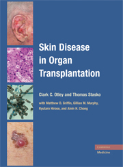 Skin Disease in Organ Transplantation