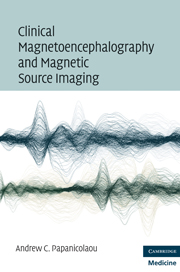 Clinical Magnetoencephalography and Magnetic Source Imaging