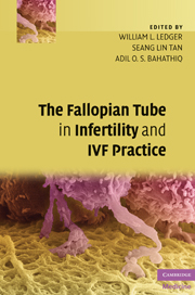 The Fallopian Tube in Infertility and IVF Practice