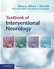 Textbook of Interventional Neurology
