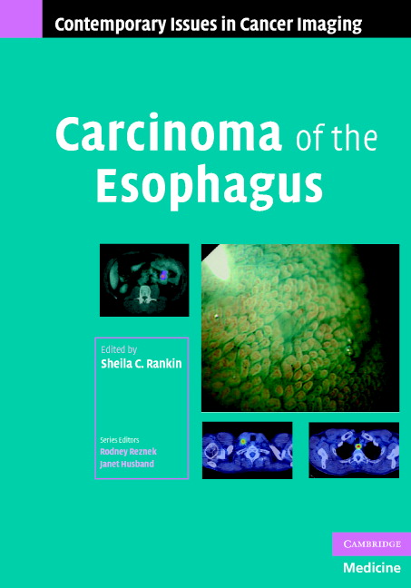 Endoscopic Ultrasound In Esophageal Cancer Chapter 4 Carcinoma Of