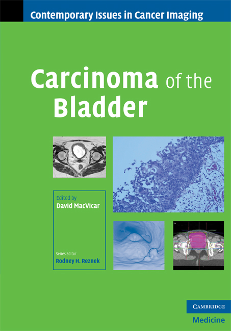 Carcinoma of the Bladder