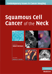 Squamous Cell Cancer of the Neck
