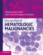 Management of Hematologic Malignancies