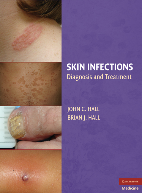 thesis on skin infections