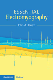 Essential Electromyography