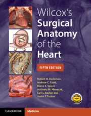 Wilcox's Surgical Anatomy of the Heart