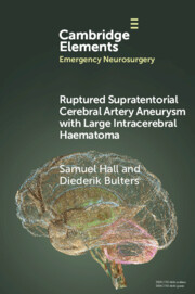 Elements in Emergency Neurosurgery