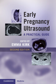 Early Pregnancy Ultrasound