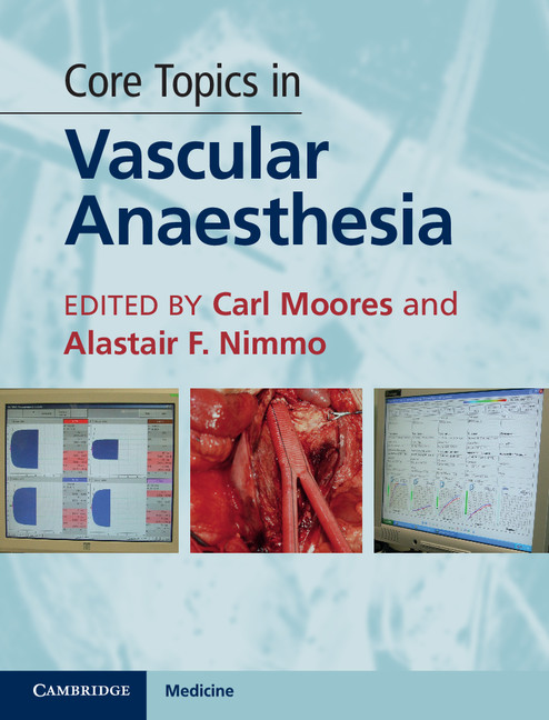 thesis topics in cardiac anaesthesia